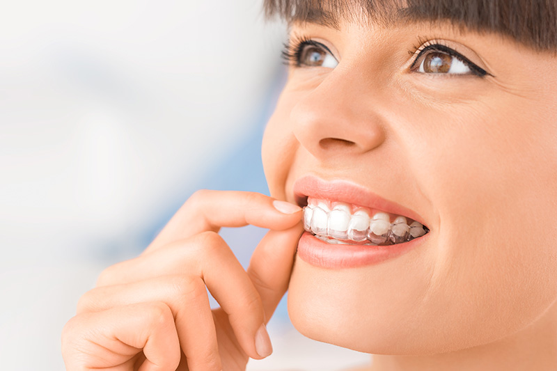 Invisalign in Homewood